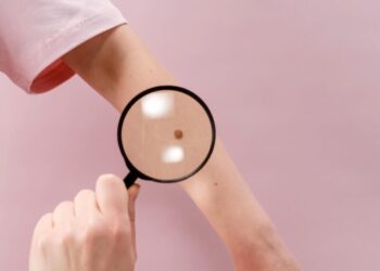 A Capri una giornata di visite gratuite per la prevenzione delle malattie della pelle